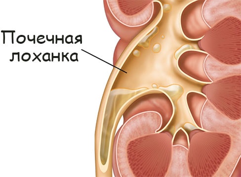 Hydra маркетплейс